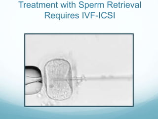 Treatment with Sperm Retrieval
Requires IVF-ICSI
 