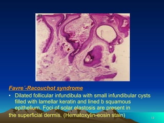 Disorders Of Elastic Tissue | PPS