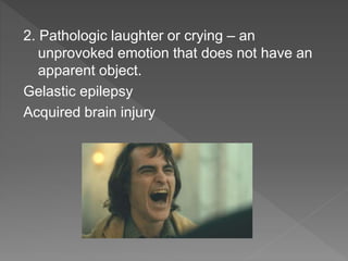 Pathological Laughter Disorders of emotion (1).pptx
