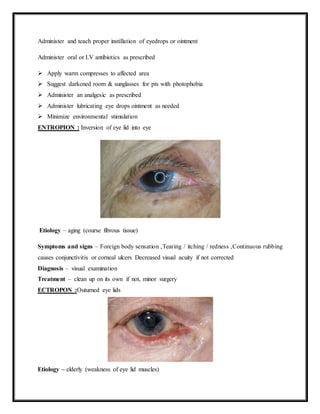 disordersofeye.docx