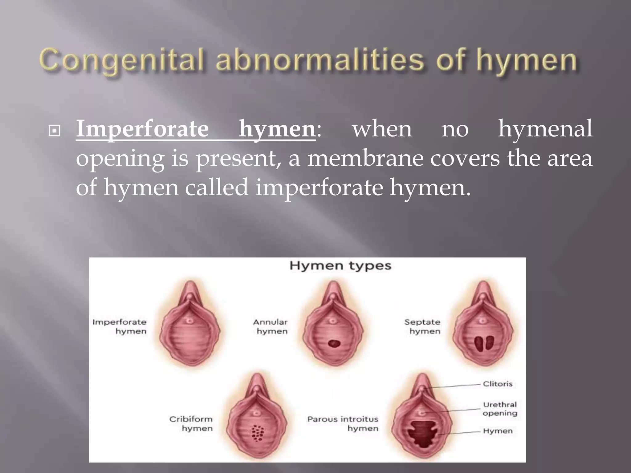 Disorders of female reproductive system | PPTX