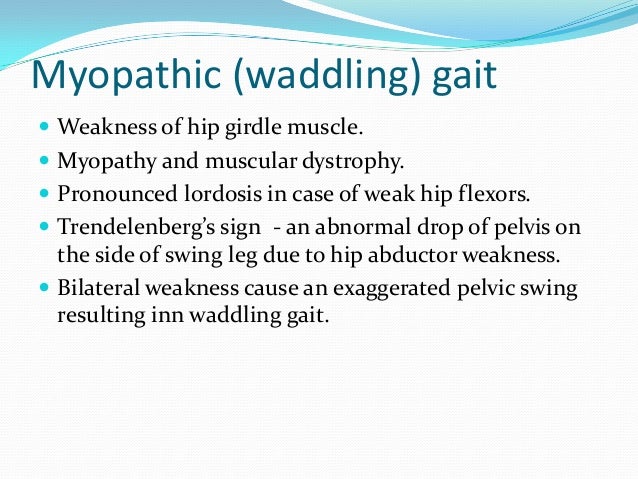 disorders of gait and station gait and station