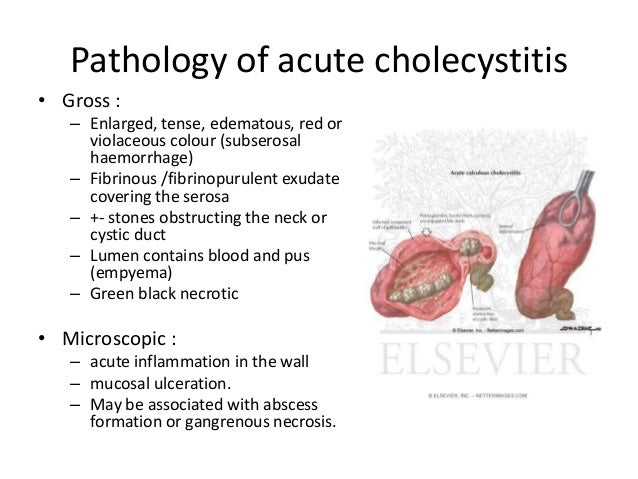 disorders of gall bladder 24 638