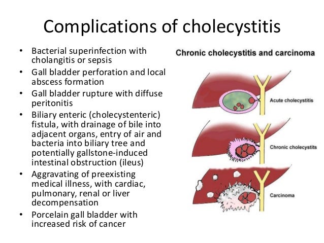 Disorders of gall bladder