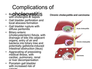 disordersofgallbladder (1).pptx