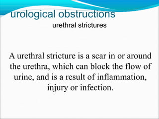 urological obstructions
urethral strictures
A urethral stricture is a scar in or around
the urethra, which can block the flow of
urine, and is a result of inflammation,
injury or infection.
 