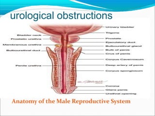 Anatomy of the Male Reproductive System
urological obstructions
 