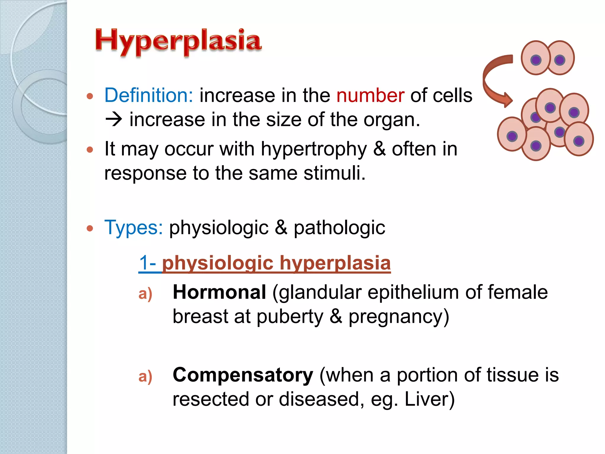 




Definition: increase in the number of cells
 increase in the size of the organ.
It may occur with hypertrophy & often in
response to the same stimuli.
Types: physiologic & pathologic
1- physiologic hyperplasia
a) Hormonal (glandular epithelium of female
breast at puberty & pregnancy)
a)

Compensatory (when a portion of tissue is
resected or diseased, eg. Liver)

 