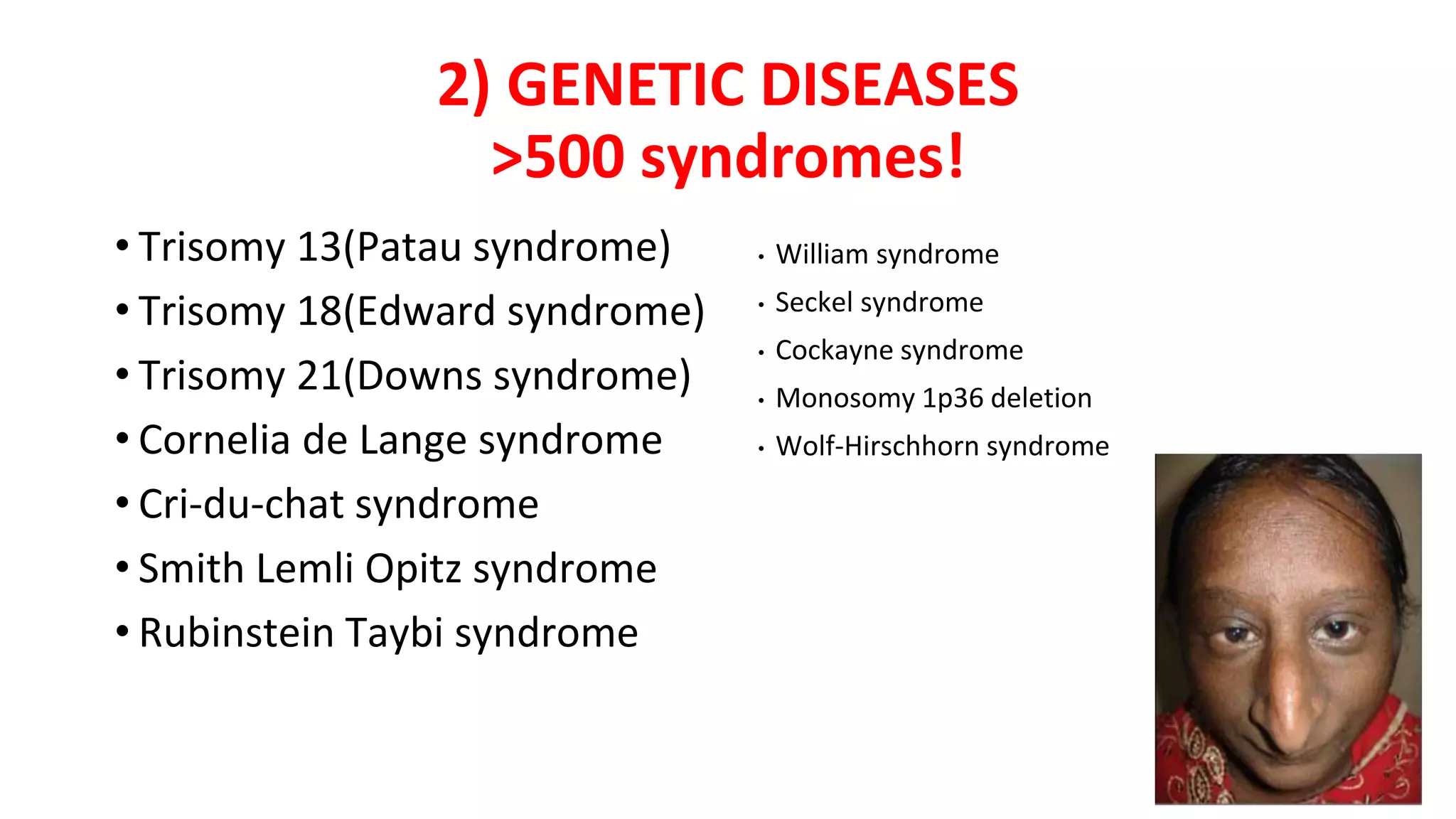 2) GENETIC DISEASES
>500 syndromes!
• Trisomy 13(Patau syndrome)
• Trisomy 18(Edward syndrome)
• Trisomy 21(Downs syndrome)
• Cornelia de Lange syndrome
• Cri-du-chat syndrome
• Smith Lemli Opitz syndrome
• Rubinstein Taybi syndrome
• William syndrome
• Seckel syndrome
• Cockayne syndrome
• Monosomy 1p36 deletion
• Wolf-Hirschhorn syndrome
 