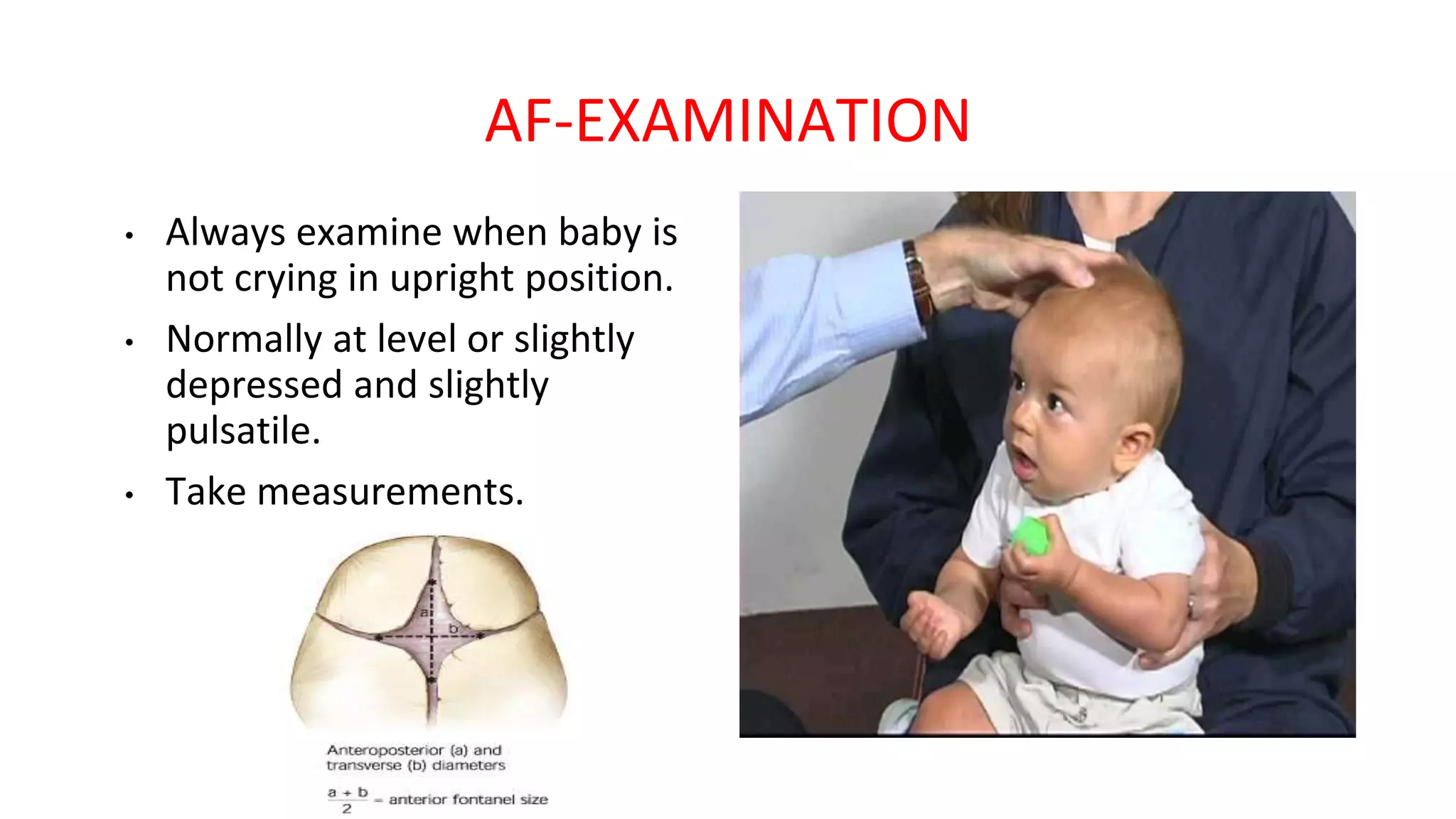 AF-EXAMINATION
• Always examine when baby is
not crying in upright position.
• Normally at level or slightly
depressed and slightly
pulsatile.
• Take measurements.
 