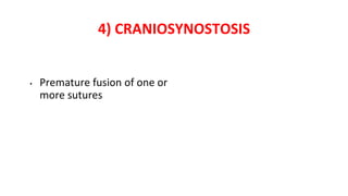 4) CRANIOSYNOSTOSIS
• Premature fusion of one or
more sutures
 