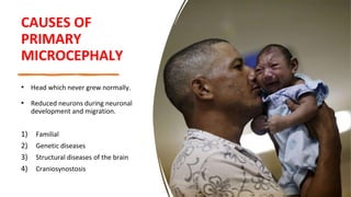 CAUSES OF
PRIMARY
MICROCEPHALY
• Head which never grew normally.
• Reduced neurons during neuronal
development and migration.
1) Familial
2) Genetic diseases
3) Structural diseases of the brain
4) Craniosynostosis
 