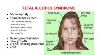 FETAL ALCOHOL SYNDROME
● Microcephaly
● Characteristics face:-
short palpebral fissure,
epicanthal folds,
depressed nasal bridge,
smooth philtrum,
thin upper lip
● Developmental delay
● Slow growth
● Vision, Hearing problems
● CHD No
RIDGE
 