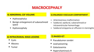 MACROCEPHALY
4) ABNORMAL CSF VOLUME
 Hydrocephalus
 Benign enlargement of subarachnoid
space
 Hydrancephaly
5) ENLARGED VASCULAR COMPARTMENT
 Arteriovenous malformation
 Subdural, epidural, subarachnoid or
intraventricular hemorrhage
 Subdural empyema or effusion in meningitis
6) INTRACRANIAL MASS LESIONS
 Cysts
 Abscess
 Tumor
 Pseudotumor cerebri
 Lead poisoning
 Galactosemia
 Hypervitaminosis A
7) RAISED ICT
 