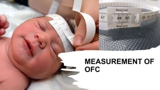 MEASUREMENT OF
OFC
 