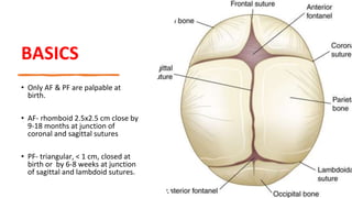 BASICS
• Only AF & PF are palpable at
birth.
• AF- rhomboid 2.5x2.5 cm close by
9-18 months at junction of
coronal and sagittal sutures
• PF- triangular, < 1 cm, closed at
birth or by 6-8 weeks at junction
of sagittal and lambdoid sutures.
 