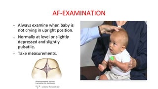 AF-EXAMINATION
• Always examine when baby is
not crying in upright position.
• Normally at level or slightly
depressed and slightly
pulsatile.
• Take measurements.
 