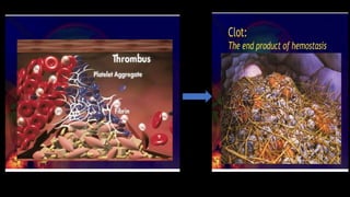 DISORDERS OF HEMOSTASIS , extrinsic and intrinsic pathway | PDF