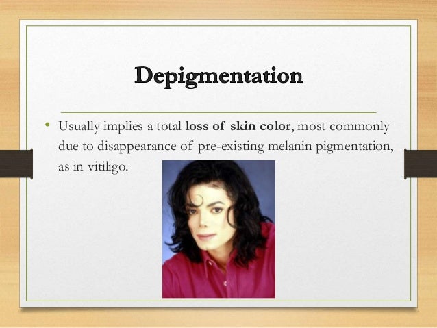 Disorders Of Hypoigmentation