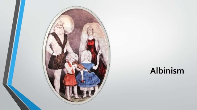 images Grabowski& Family Albinism Instagram disorders of hypoigmentation cont