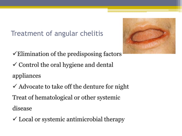 Disorders of lip | PPTX