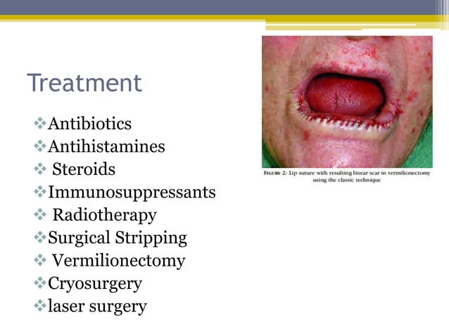 Disorders of lip | PPTX