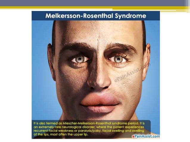 Disorders of lip | PPTX