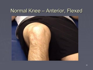 33
Normal Knee – Anterior, FlexedNormal Knee – Anterior, Flexed
 
