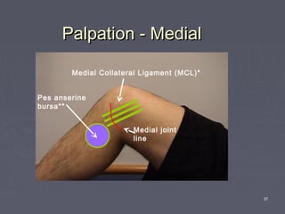 37
Palpation - MedialPalpation - Medial
Medial Collateral Ligament (MCL)*
Pes anserine
bursa**
Medial joint
line
 