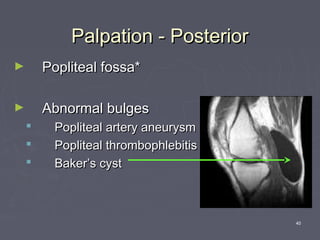40
Palpation - PosteriorPalpation - Posterior
► Popliteal fossa*Popliteal fossa*
► Abnormal bulgesAbnormal bulges
 Popliteal artery aneurysmPopliteal artery aneurysm
 Popliteal thrombophlebitisPopliteal thrombophlebitis
 Baker’s cystBaker’s cyst
 
