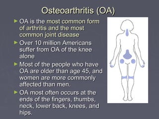 Osteoarthritis (OA)Osteoarthritis (OA)
► OA is theOA is the most common formmost common form
of arthritis and the mostof arthritis and the most
common joint diseasecommon joint disease
► Over 10 million AmericansOver 10 million Americans
suffer from OA of the kneesuffer from OA of the knee
alonealone
► Most of the people who haveMost of the people who have
OA are older than age 45, andOA are older than age 45, and
women are more commonlywomen are more commonly
affected than men.affected than men.
► OA most often occurs at theOA most often occurs at the
ends of the fingers, thumbs,ends of the fingers, thumbs,
neck, lower back, knees, andneck, lower back, knees, and
hips.hips.
 