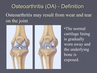 Osteoarthritis (OA) - DefinitionOsteoarthritis (OA) - Definition
Osteoarthritis may result from wear and tear
on the joint
•The normal
cartilage lining
is gradually
worn away and
the underlying
bone is
exposed.
 