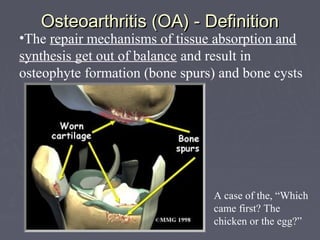 Osteoarthritis (OA) - DefinitionOsteoarthritis (OA) - Definition
•The repair mechanisms of tissue absorption and
synthesis get out of balance and result in
osteophyte formation (bone spurs) and bone cysts
A case of the, “Which
came first? The
chicken or the egg?”
 