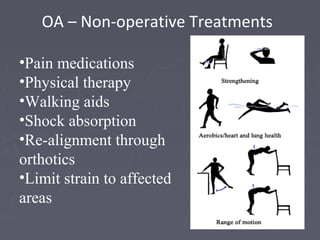 OA – Non-operative Treatments
•Pain medications
•Physical therapy
•Walking aids
•Shock absorption
•Re-alignment through
orthotics
•Limit strain to affected
areas
 