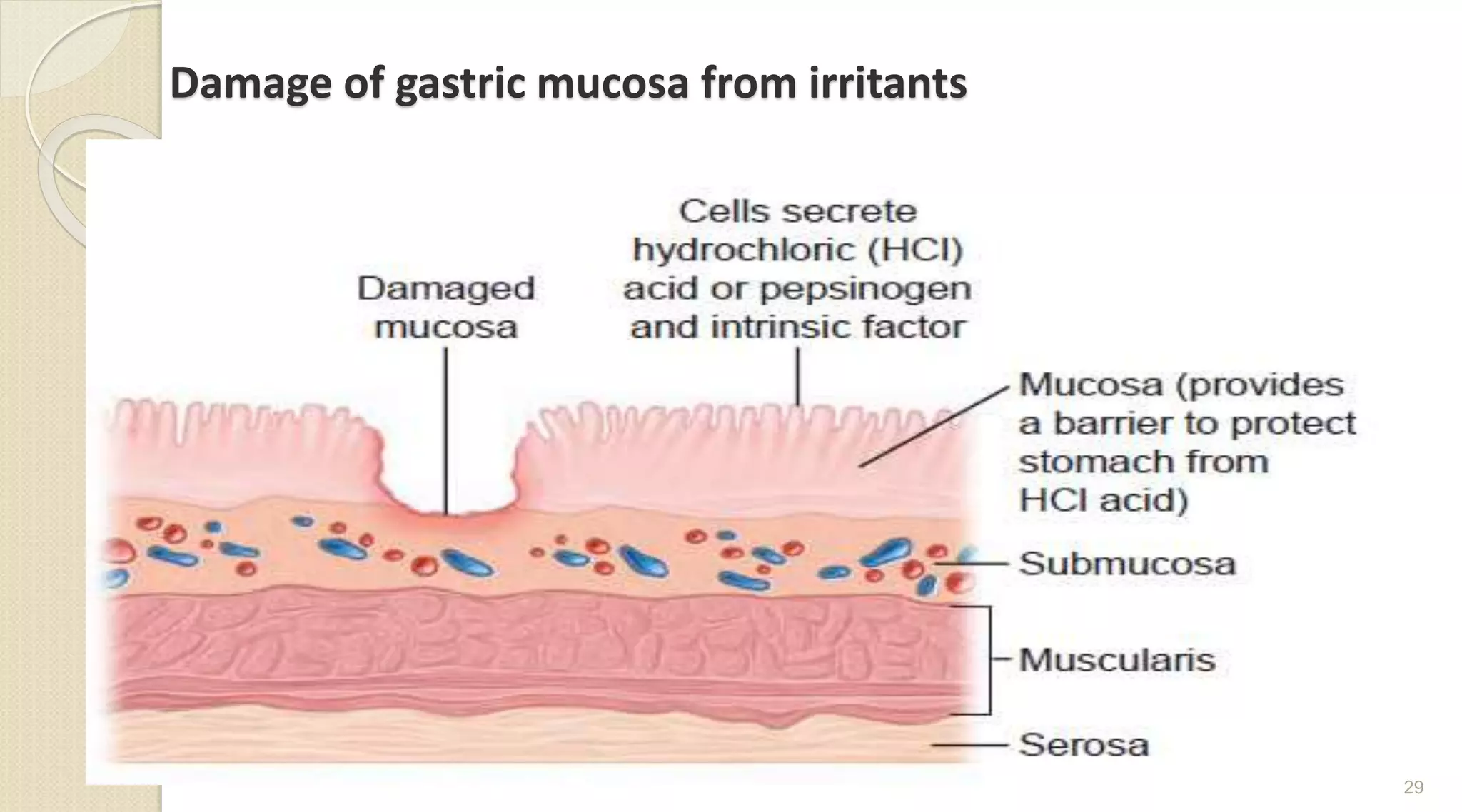 Damage of gastric mucosa from irritants
29
 