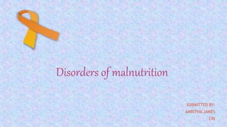 Disorders of malnutrition
SUBMITTED BY:
AMRITHA JAMES
CRI
 