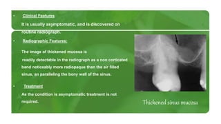 Disorders of maxillary sinus