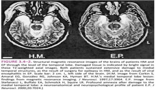 Memory Disorder Disorders of memory | PPTX