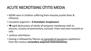 Disorders of middle ear revision notes | PDF