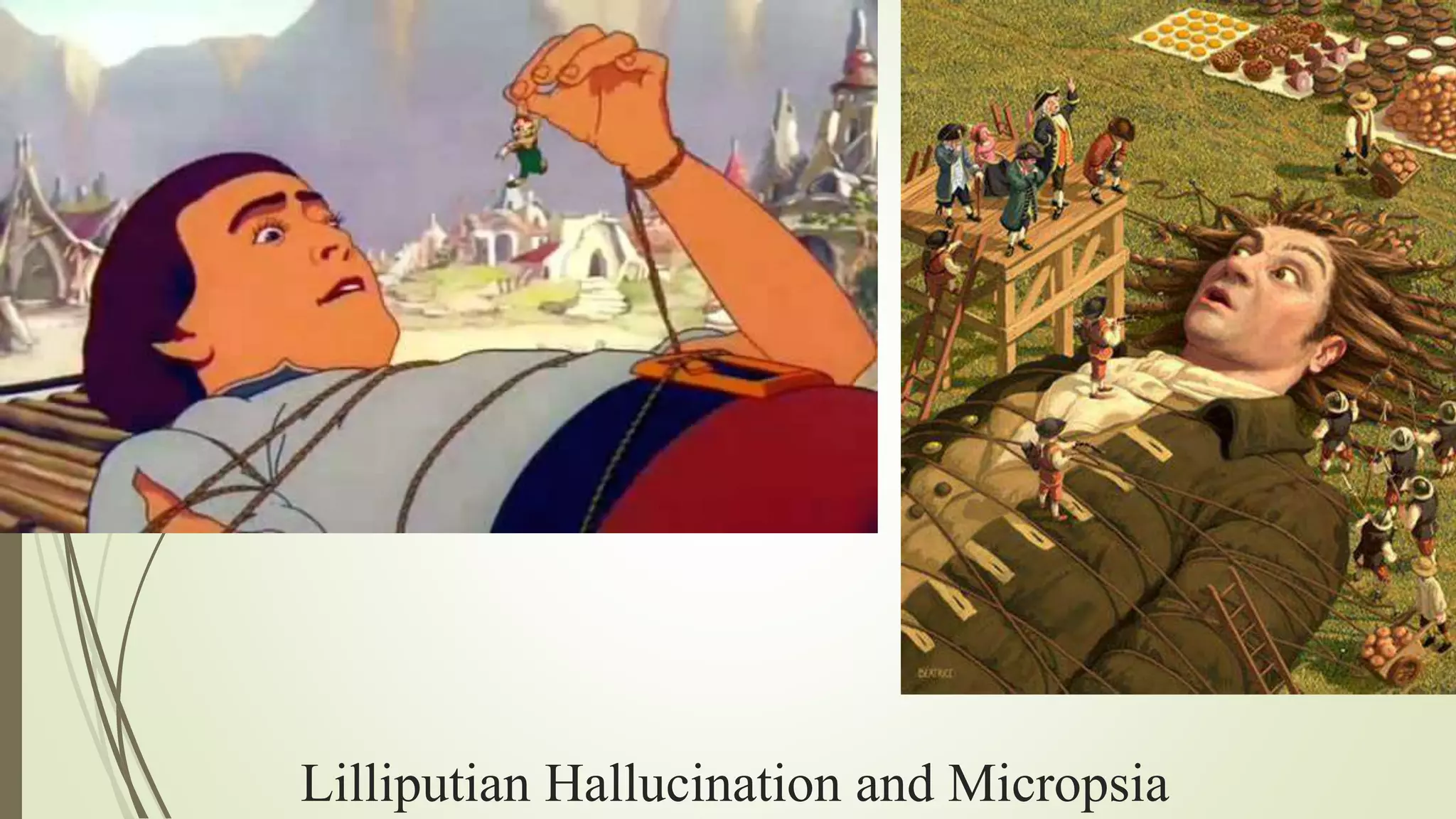 Lilliputian Hallucination and Micropsia
 