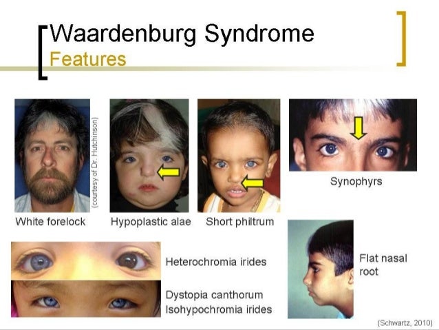 Disorders of pigmentation