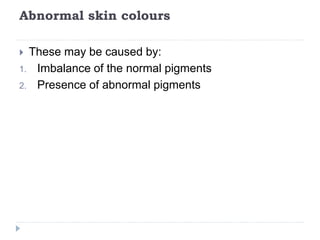 Disorders of pigmentation | PPTX
