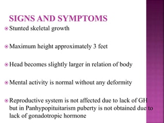  Posterior Pituitary disorder characterized by excess
excretion of water through urine
 