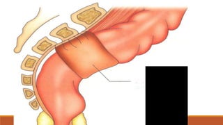 Disorders of rectum | PPTX