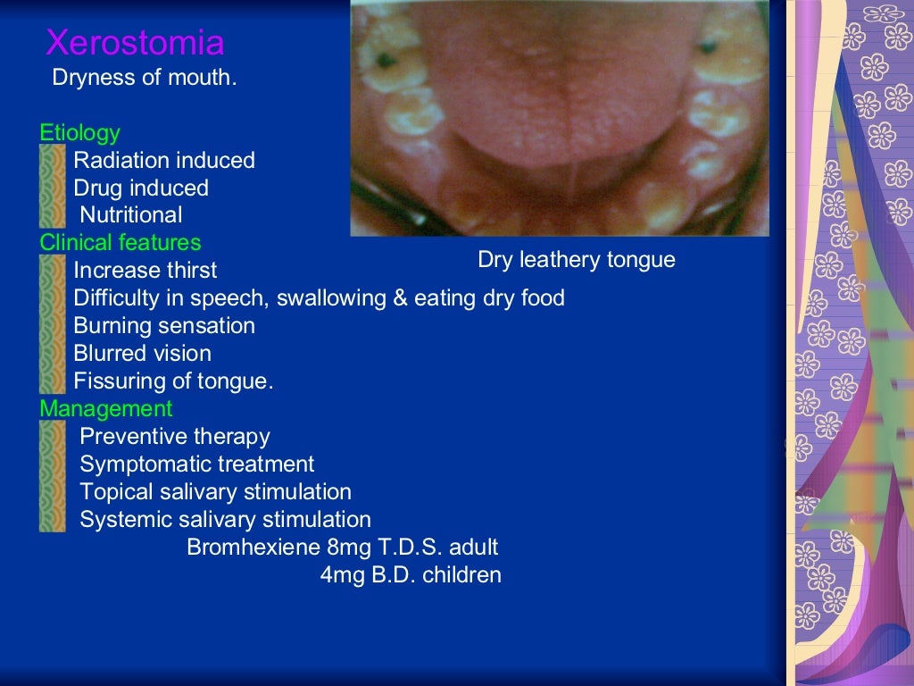 Disorders of salivary glands