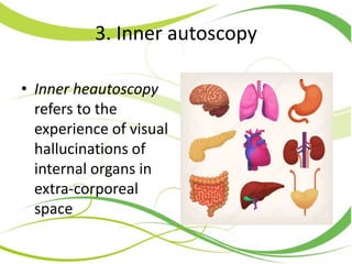 3. Inner autoscopy
• Inner heautoscopy
refers to the
experience of visual
hallucinations of
internal organs in
extra-corporeal
space
 