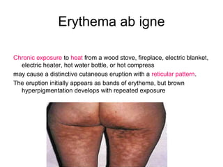Dermatology 5th year, 3rd lecture (Dr. Ali El-Ethawi) | PPT