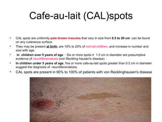 Cal Spot R Chest dermatology.Disorders of skin color.(dr.ali) | PPT