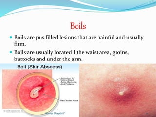 Disorders of skin in children | PPTX