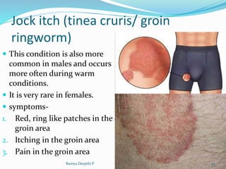 Disorders of skin in children | PPTX